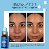 MD Restoring Power-C Serum