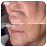 VOL.U.LIFT™ GLP-1 4D Skin Rebound Complex