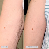VOL.U.LIFT™ BODY GLP-1/GIP sculpt + firm treatment complex