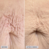 VOL.U.LIFT™ BODY GLP-1/GIP sculpt + firm treatment complex
